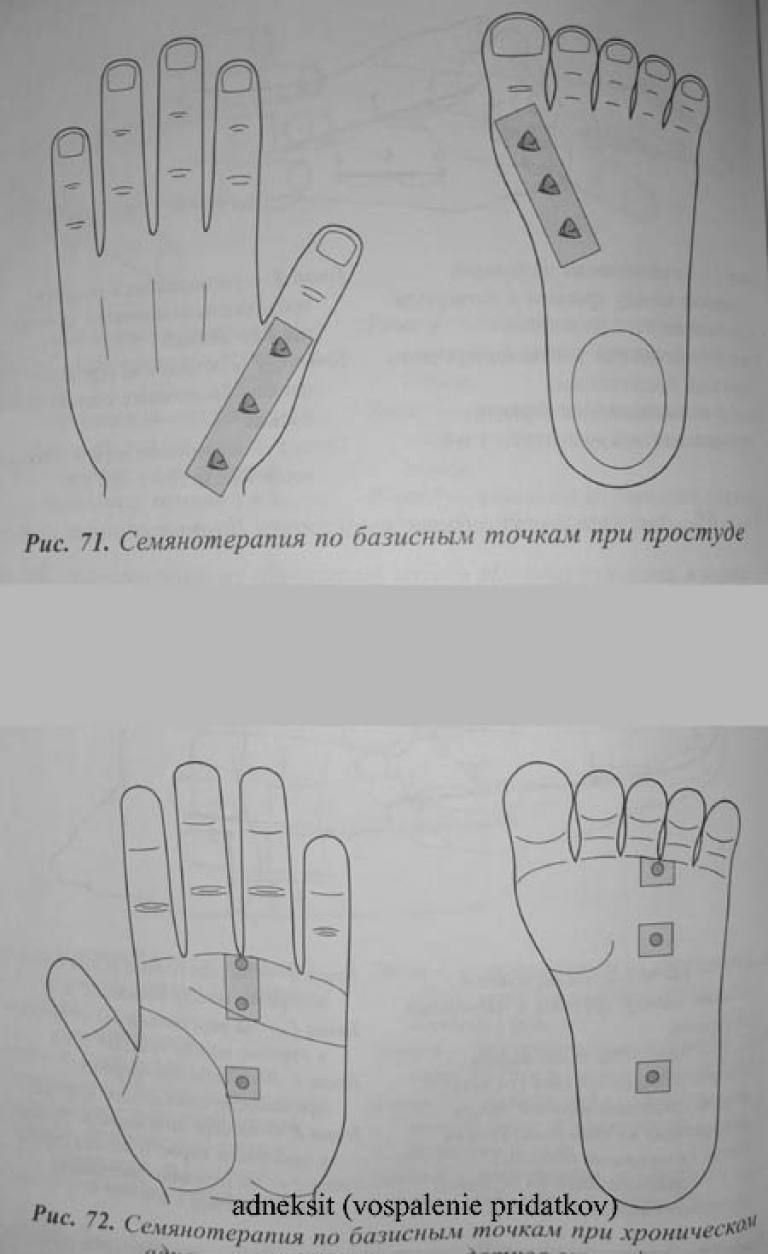 Точки при простуде. Точки Су Джок при простуде. Энергетические базисные точки Су Джок. Энергетические базисные точки Су Джок на ладонях. Су Джок терапия семянотерапия.